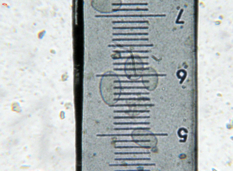 Su bruciato (cfr. Pyronema sp.)